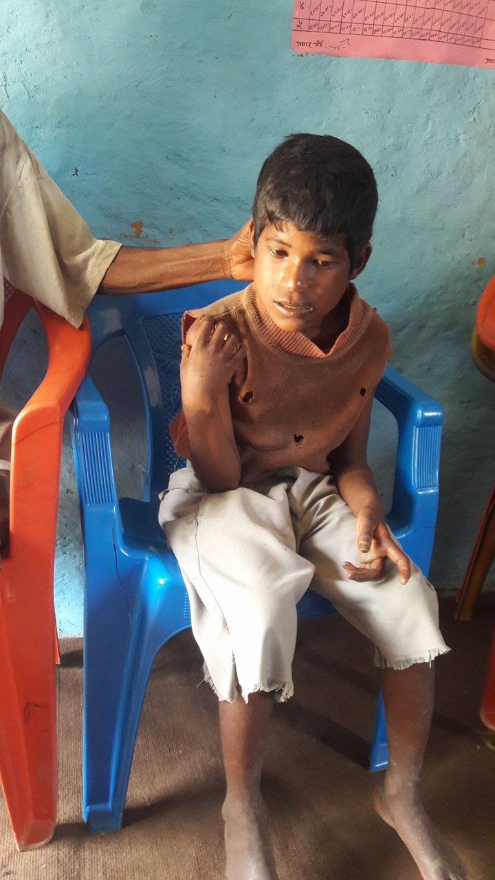 उपचार गर्न नसक्दा घरमै बाँधिए बालक