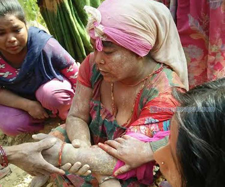 ढिस्कोले पुरिएर महिलाको मृत्यु