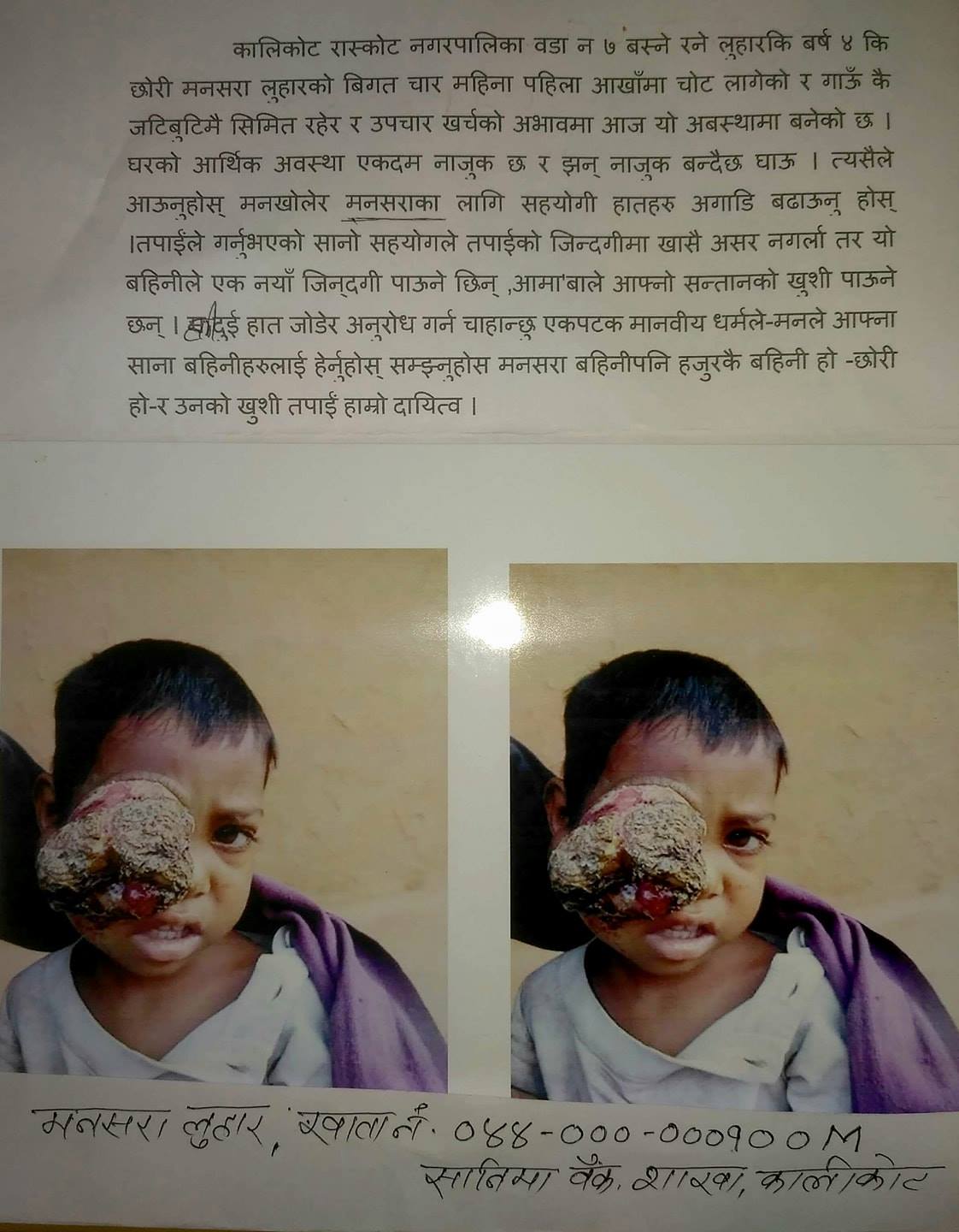 आँखाको ट्युमर उपचारका लागि सहयोग खोज्दै अभिभावक