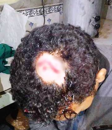 शिक्षकमाथि वडाअध्यक्षले कुर्सी हानेपछि…