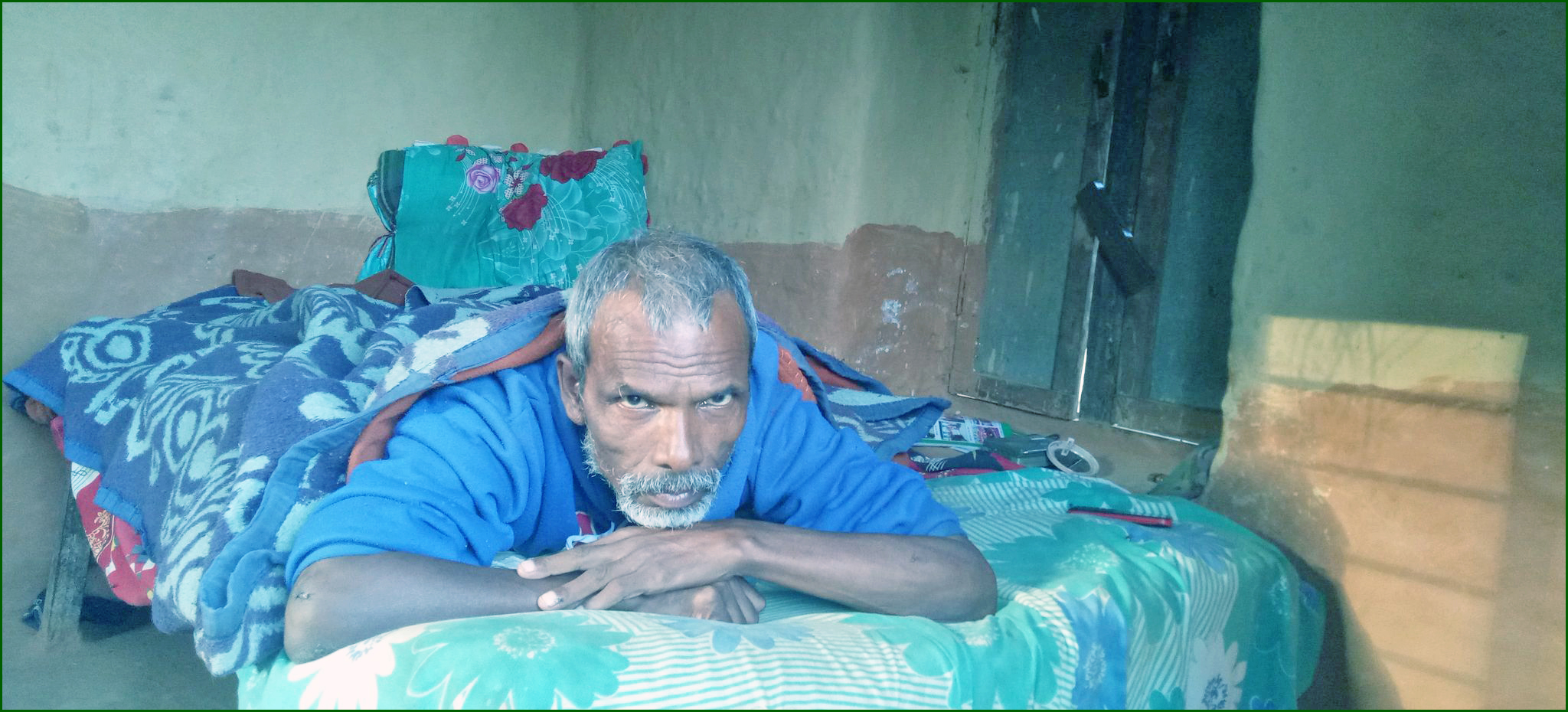 ढाड भाँचिएर उपचारका लागी पैसा नहुँदा घरमै थलिए कर्ण